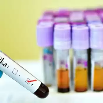 केरल में ज़ीका वायरस की दस्तक  संदेह, NIV भेजे गए 19 सैम्पल