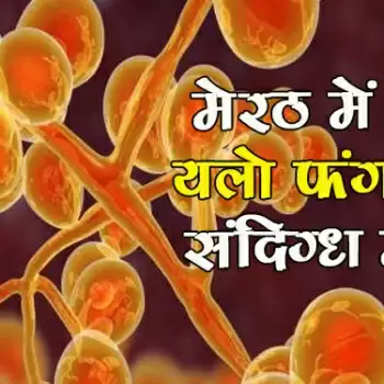 मेरठ में मिला यलो फंगस का संदिग्ध मरीज