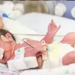 नवजातों पर भारी, एनेमिया की बीमारी
