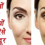 कम उम्र में हो रही झुर्रियों के लिए अपनाएं ये घरेलू उपाय
