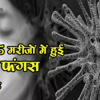Meerut : 5 मरीजों में हुई ब्लैक फंगस की पुष्टि