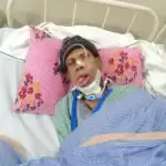 डॉक्टर ने किया कमाल, फिबुला से बनाया जबड़ा, कैंसर के मरीज को कर दिया स्वस्थ