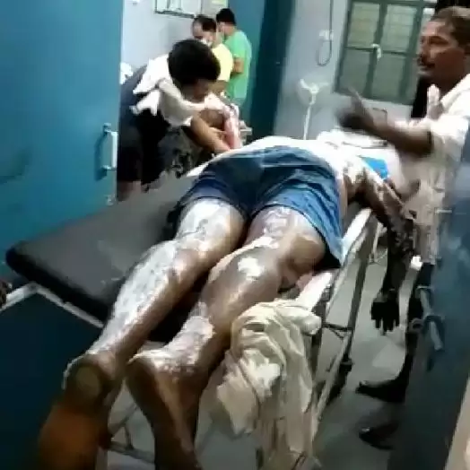 भोज के दौरान गैस सिलेंडर में लगी आग