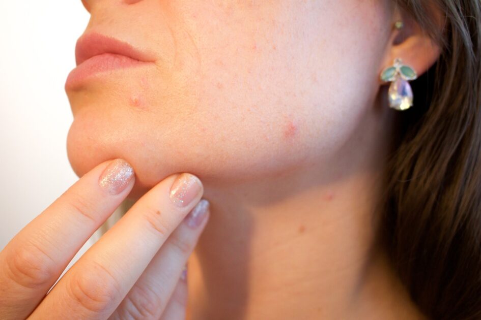 summer skin problems and solutions in hindi