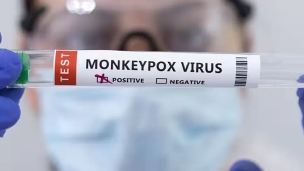 monkey pox