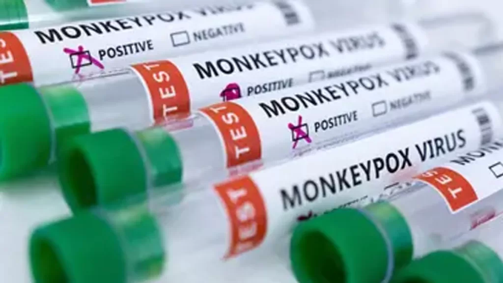 monkeypox