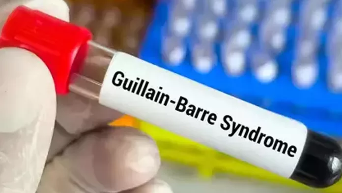 gbs
